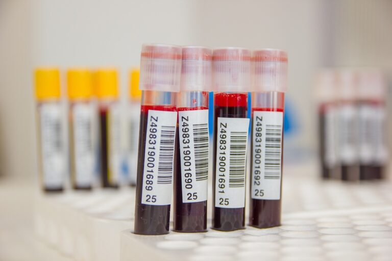 Organizacja publicznej służby krwi z uwzględnieniem projektu e-krew