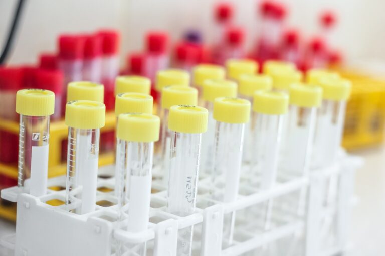 Diagnostyka laboratoryjna chorób nowotworowych